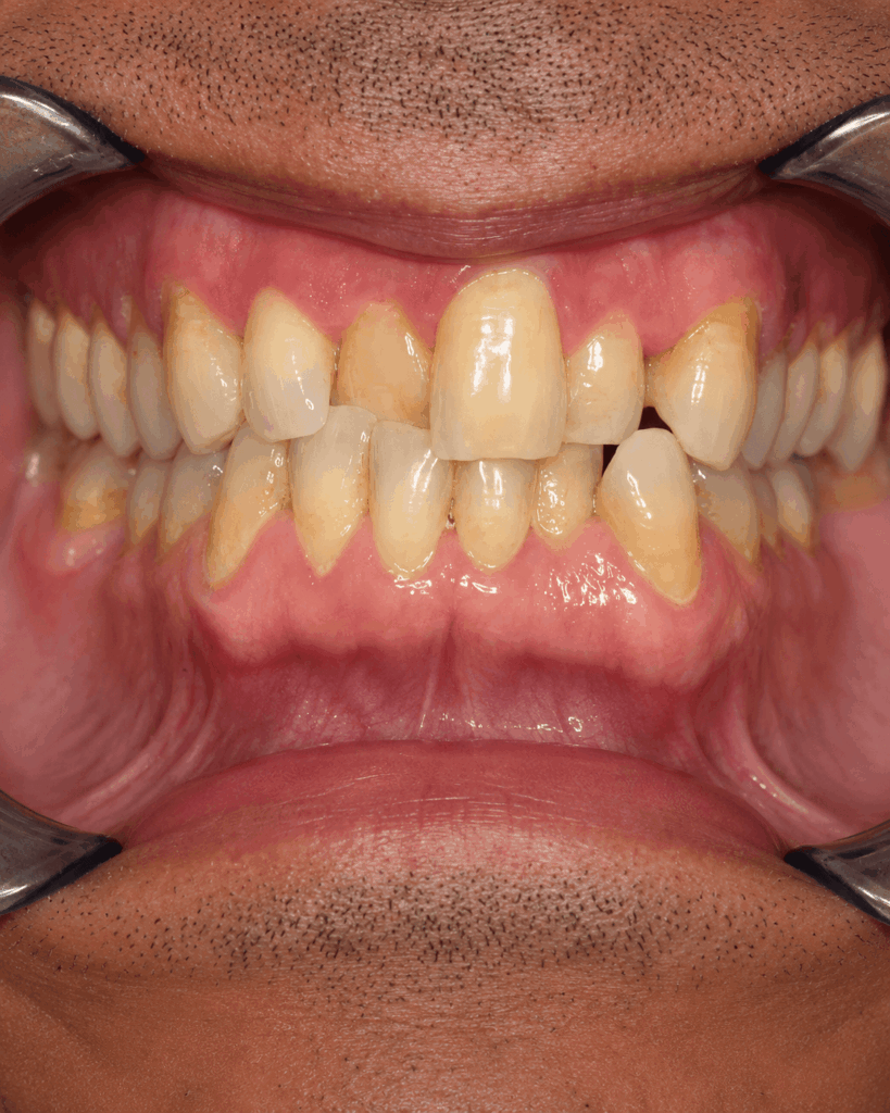 Case Study 13